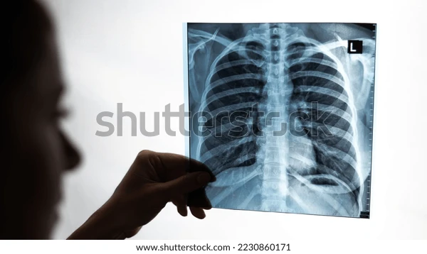 2230860171